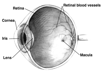 Macular Hole * Ophthalmologist Retinal Surgeon New York * Eye Doctor Mt ...