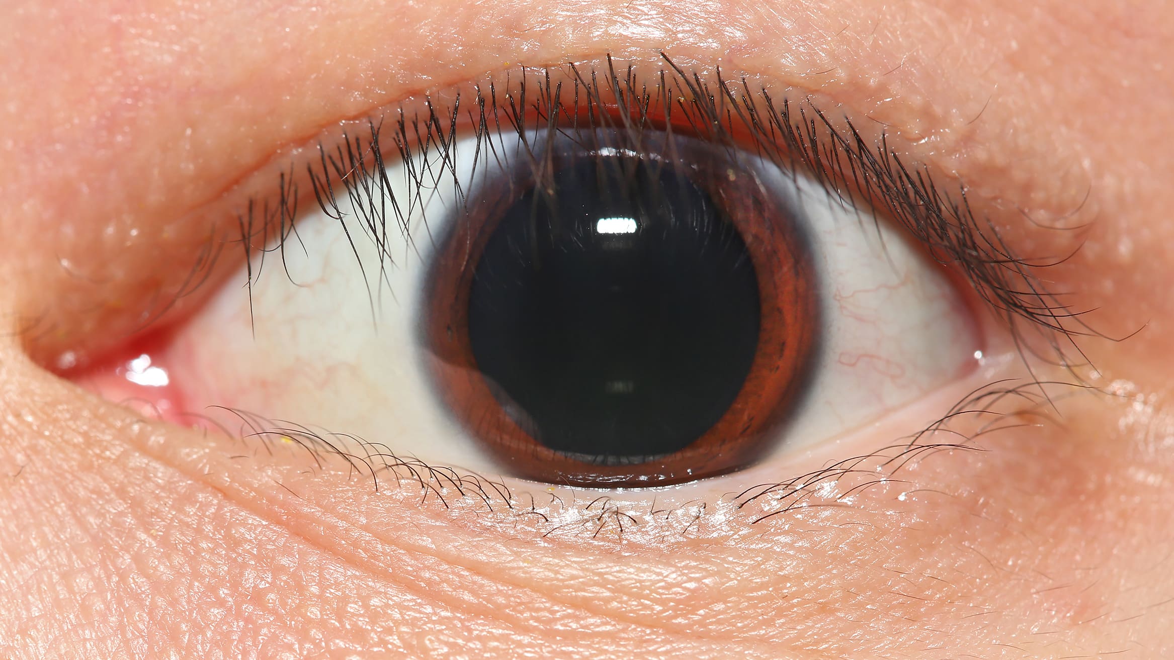Close-up of a brown eye pupil dilation.