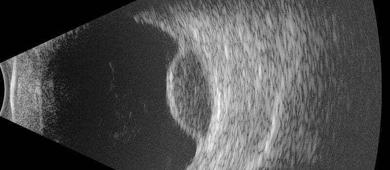 Ultrasound scan showing internal body structures.